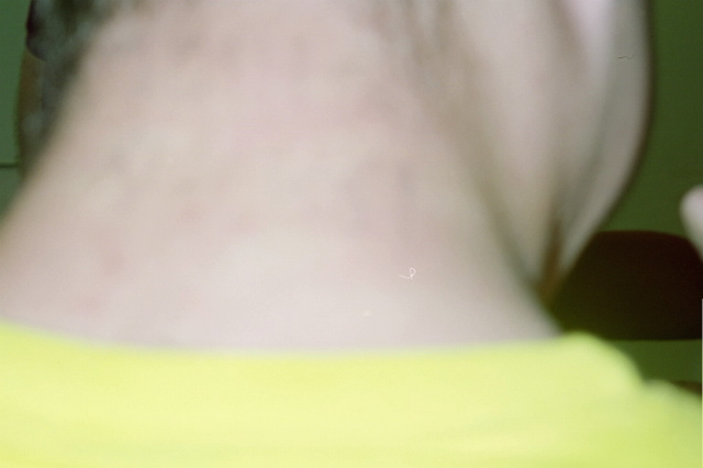 Josh Goldberg's neck, after Nathan wrote "Josh Sucks" on it